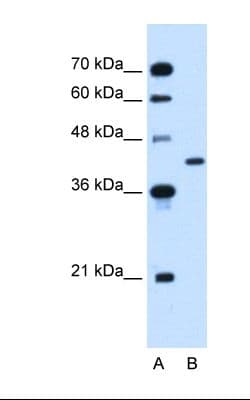 GOT2 Antibody (aa40-89)