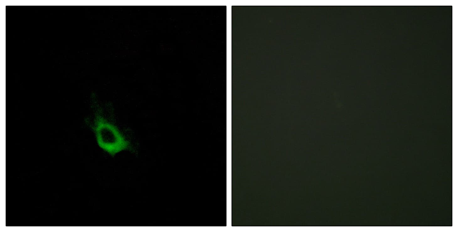 Polyclonal Rabbit anti-Human CARD10 / CARMA3 Antibody (aa481-530, IF, WB)