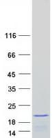 Human RPS19 / Ribosomal Protein S19 (Recombinant Myc-DDK (Flag))