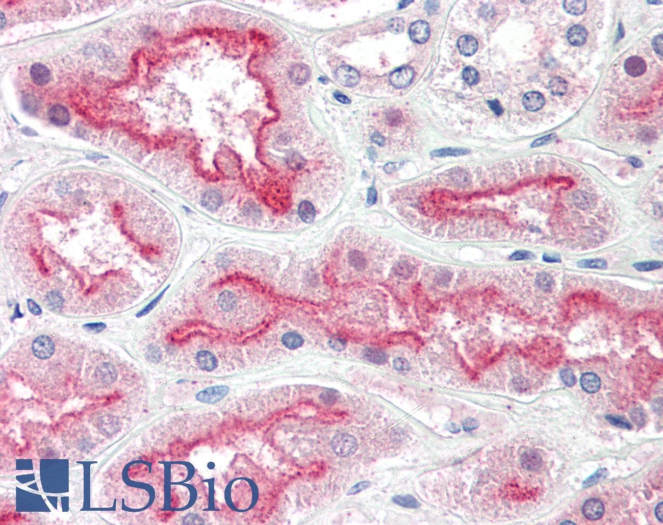 IHC-plus™ AGAP3 / CENTG3 / MRIP-1 Antibody (aa899-911)