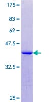 Human p84 / THOC1 Protein (Recombinant GST, N-terminus)
