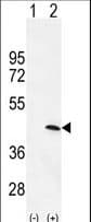 PRKAG1 / AMPK Gamma 1 Antibody (aa1-30)