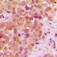 Polyclonal Rabbit anti-Human UBR5 Antibody (N-Terminus, IHC, WB)