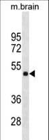 HMBOX1 Antibody (aa197-223)