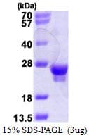 Human RAB18 Protein (Recombinant His)