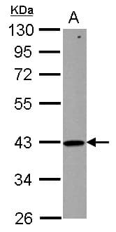 ZNHIT2 Antibody