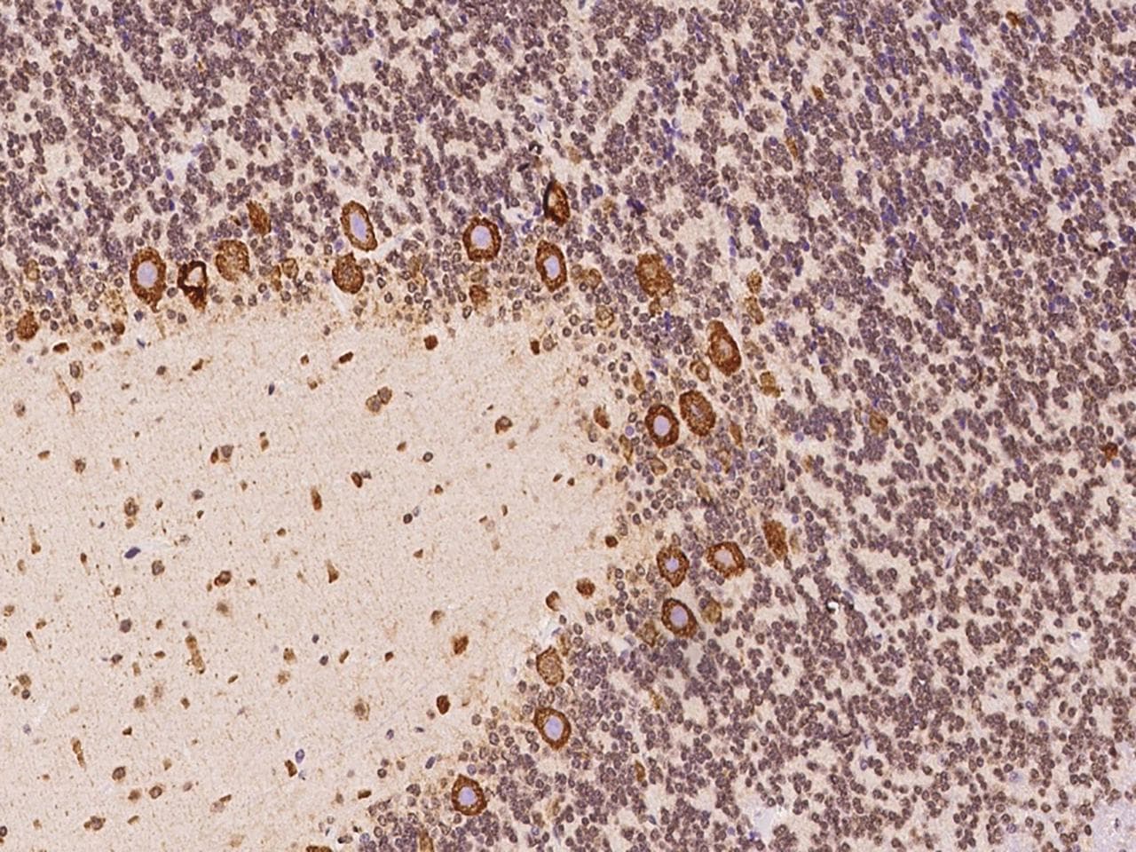 TMEM38A Antibody