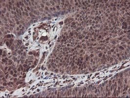 SETD7 / SET7 Antibody (clone OTI2D10)