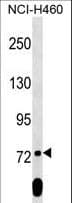 SCML2 Antibody (aa348-375)
