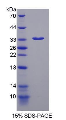Rat EML2 / EMAP2 Protein (Recombinant His-S)