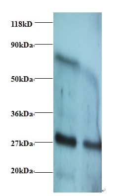 IFN Gamma / Interferon Gamma Antibody