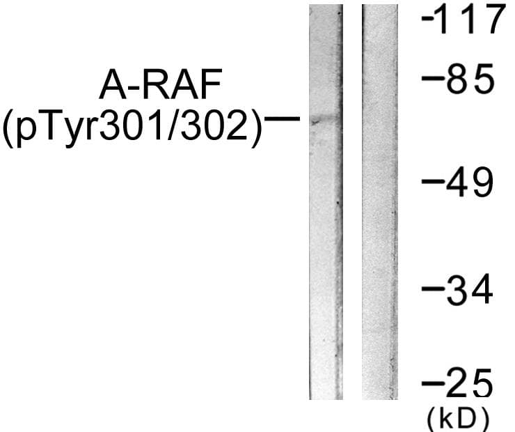 ARAF / ARAF1 / A-RAF Antibody (phospho-Tyr302)