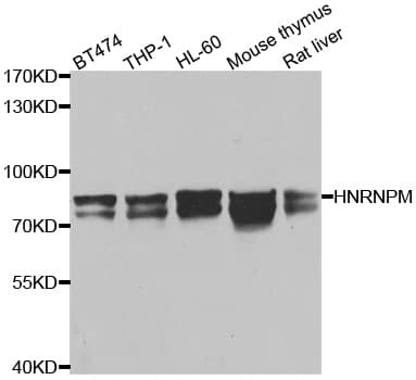 HNRPM / HNRNPM Antibody