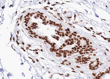 Polyclonal Rabbit anti-Human STAT2 Antibody (phospho-Tyr690, IHC, IF, WB)