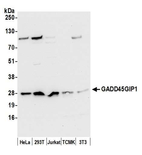 Polyclonal Rabbit anti-Human GADD45GIP1 / CRIF1 Antibody (aa150-200, WB)