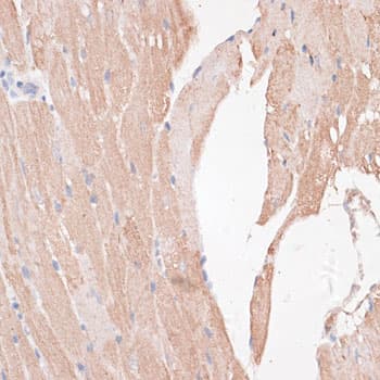 KDM8 / JMJD5 / FLJ13798 Antibody