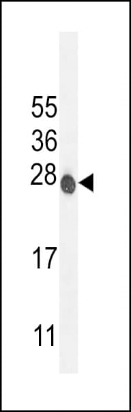 IHC-plus™ ATP6V0C / VATL Antibody (aa100-126)