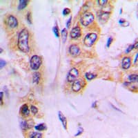 Polyclonal Rabbit anti-Human ALDH3B1 Antibody (Internal, IHC, WB)