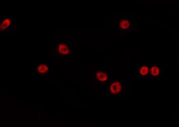 FOXD4L1 / FOXD5 Antibody