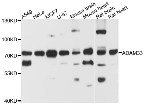 Polyclonal Rabbit anti-Human ADAM33 Antibody (WB)