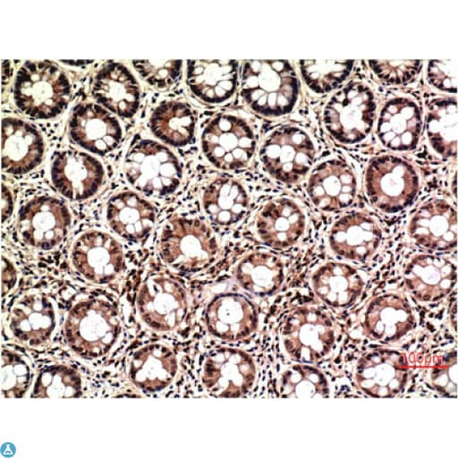 ERK1 + ERK2 Antibody