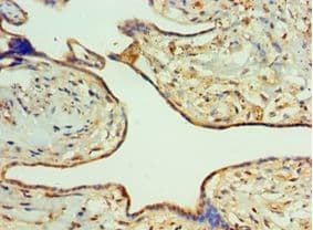 RICK / RIP2 Antibody (aa1-540)