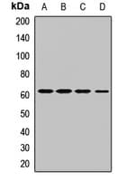 Polyclonal Rabbit anti-Human ATL3 Antibody (WB)