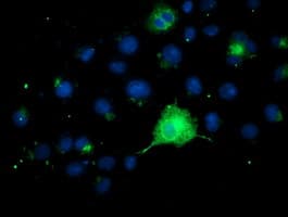 FGFR2 / FGF Receptor 2 Antibody (clone OTI5C5)