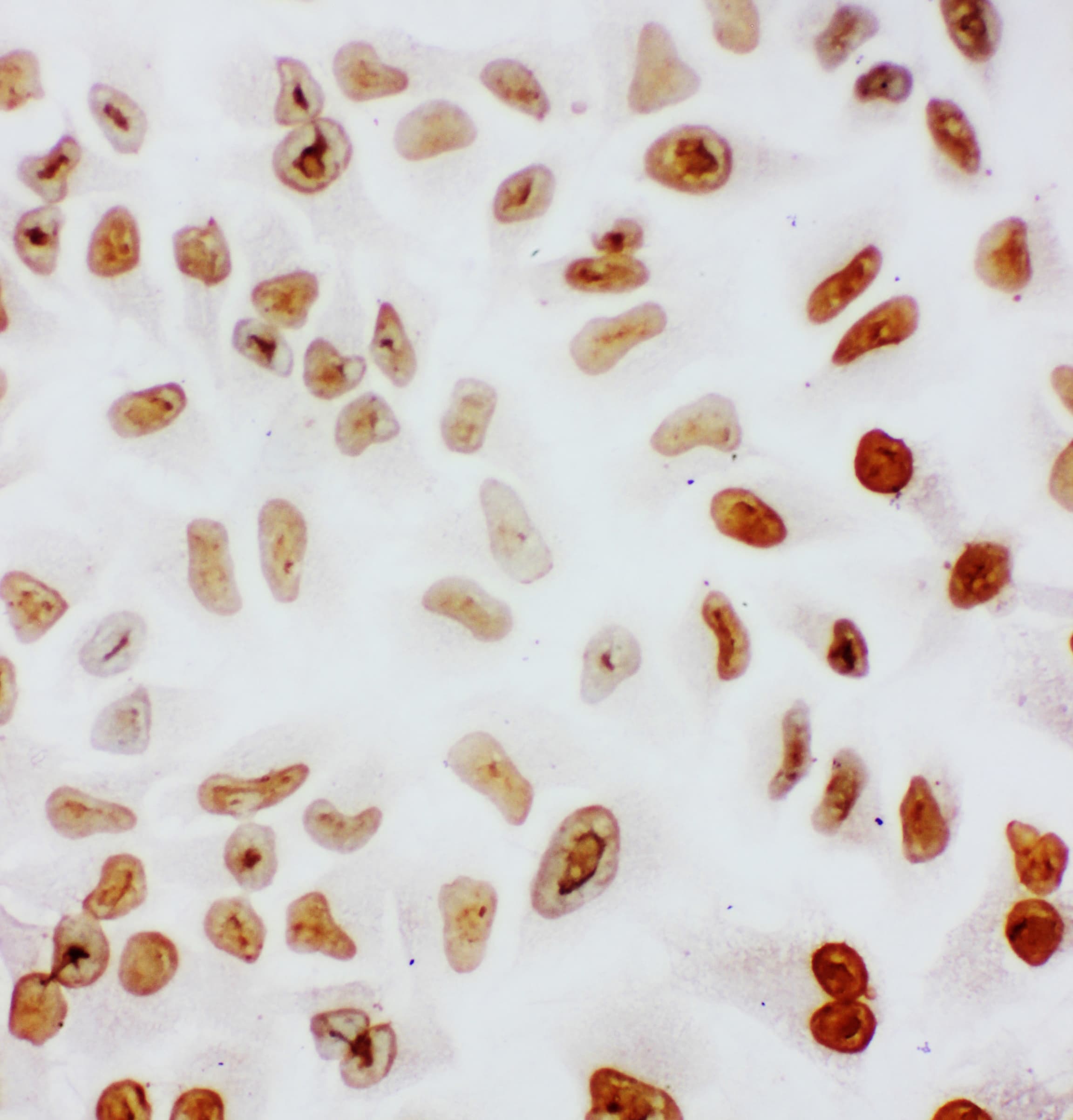 SF1 Antibody (aa11-30)