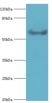 Polyclonal Rabbit anti-Human GRK6 Antibody (aa1-170, IHC, WB)