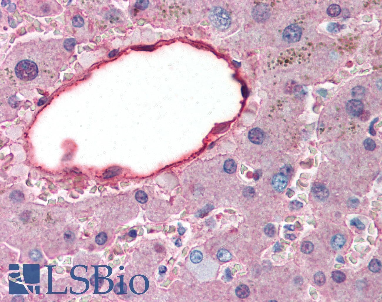 IHC-plus™ Polyclonal Rabbit anti-Human ALB / Serum Albumin Antibody (Biotin, IHC, WB)