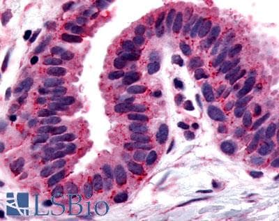 IHC-plus™ GPRC5A / RAI3 Antibody (C-Terminus)
