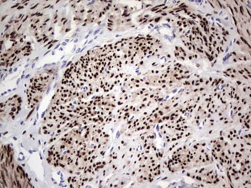 Monoclonal Mouse anti-Human PR / Progesterone Receptor Antibody (clone OTI16H2, aa1-298, IHC, WB)