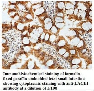 Polyclonal Rabbit anti-Human LACE1 Antibody (aa4-201, IHC, WB)