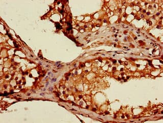 Polyclonal Rabbit anti-Human STAT1 Antibody
