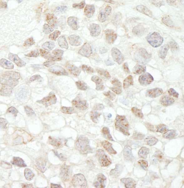 Polyclonal Rabbit anti-Human MED18 Antibody (aa150-C-term, IHC, WB)