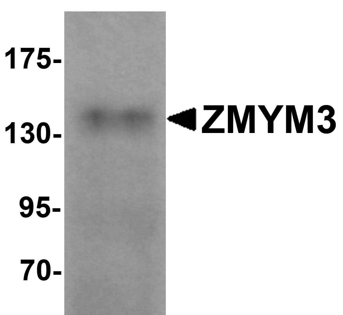 IHC-plus™ ZMYM3 Antibody