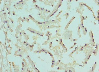 Polyclonal Rabbit anti-Human ATF1 Antibody (aa1-210, IHC, WB)