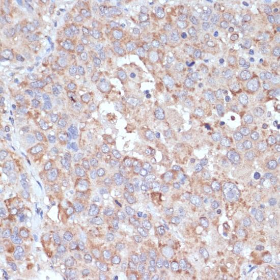 YAP / YAP1 Antibody