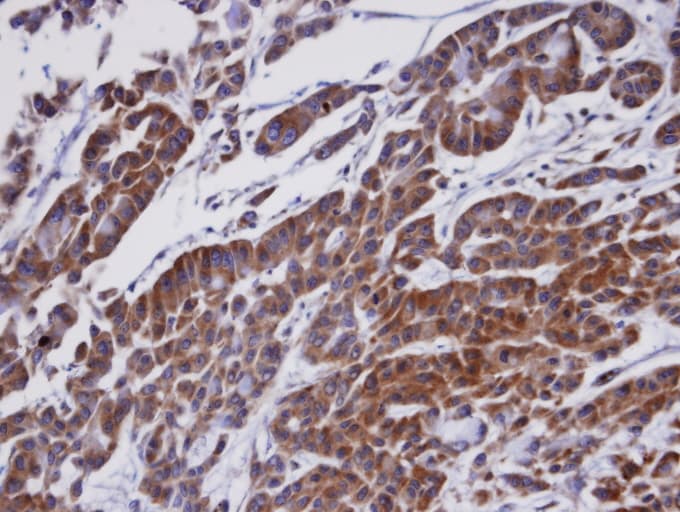 Polyclonal Rabbit anti-Human OSBPL1A / ORP1 Antibody (aa888-950, IHC, WB)