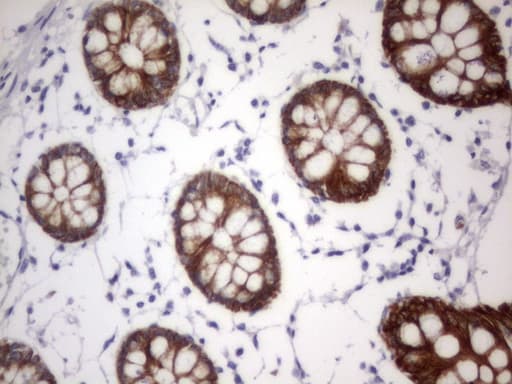 Acidic Cytokeratin Antibody (clone 8F5)