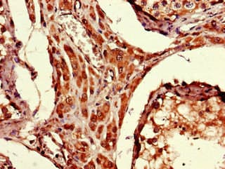 ARRDC1-AS1 / C9orf37 Antibody