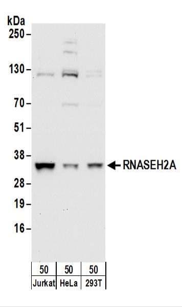 Polyclonal Rabbit anti-Human RNASEH2A Antibody (aa250-300, WB)