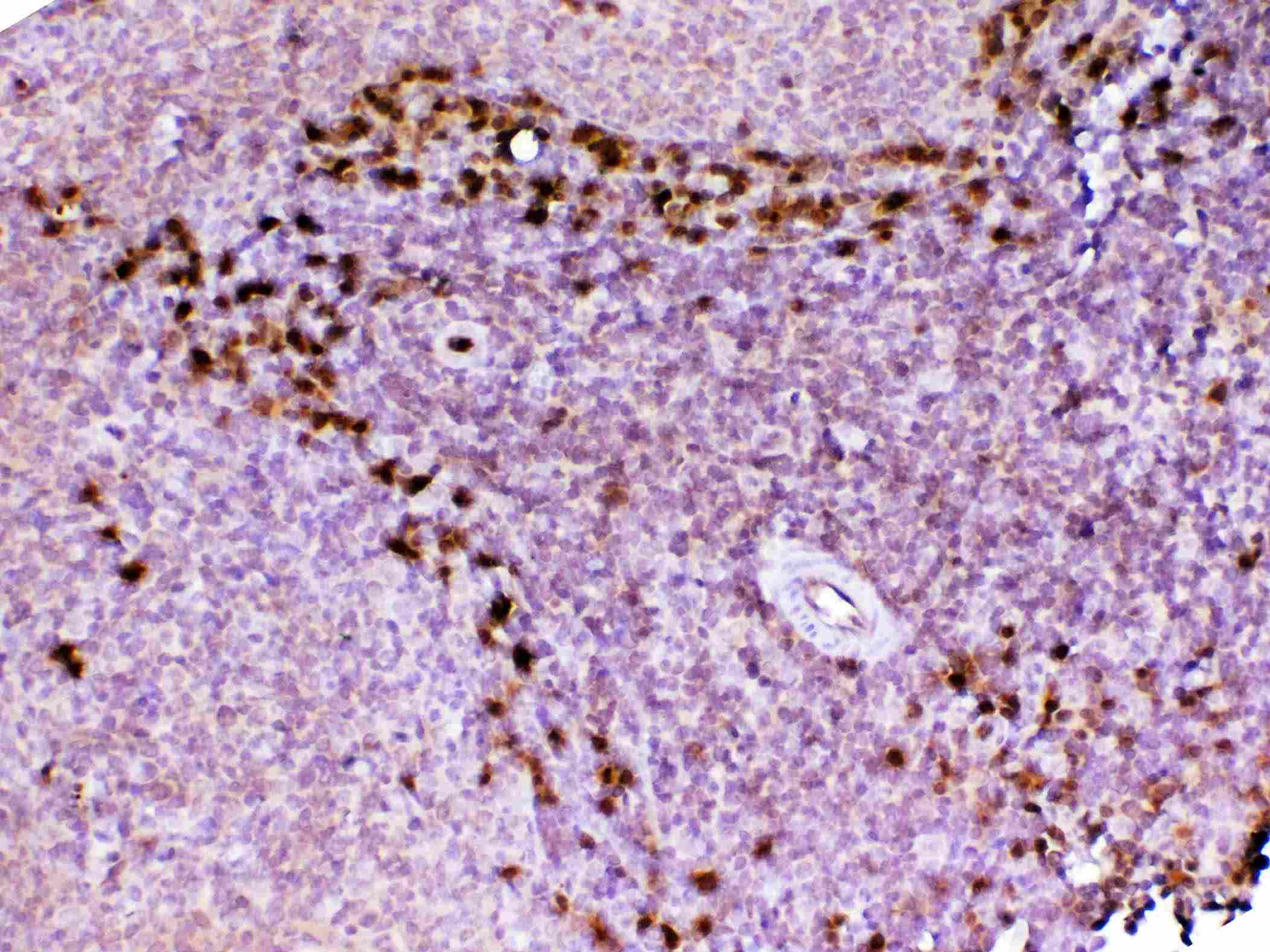 ADA / Adenosine Deaminase Antibody