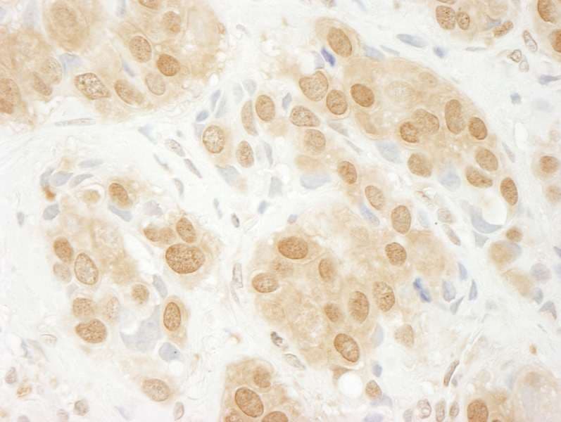 Polyclonal Rabbit anti-Human MAPK3 / ERK1 Antibody (aa329-379, IHC, WB)