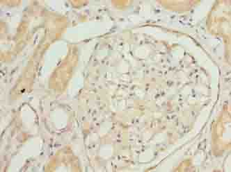 Polyclonal Rabbit anti-Human COA1 Antibody (IHC)