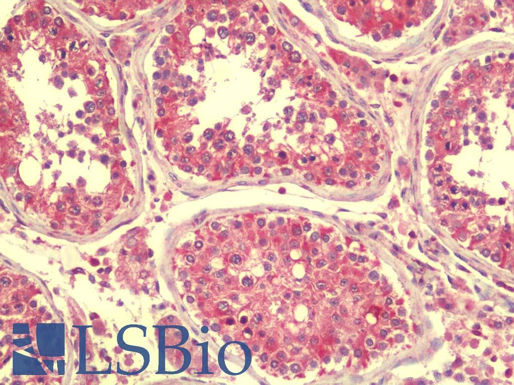 IHC-plus™ SPINK2 Antibody