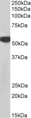 IHC-plus™ PTBP1 Antibody (aa2-14)