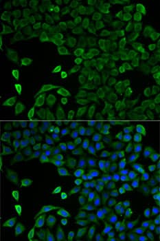 Polyclonal Rabbit anti-Human SLC25A13 / CITRIN Antibody (IHC, IF, WB)