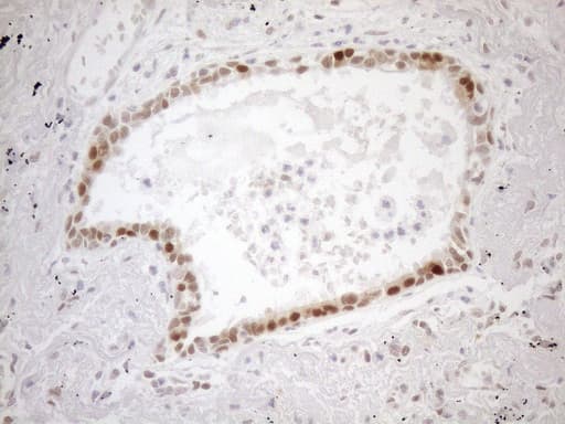 Monoclonal Mouse anti-Human MGMT Antibody (clone OTI2F10, IHC, WB)